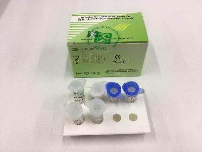 Detection Kit for 2019 Novel Coronavirus RNA (PCR Fluorescence Probing)