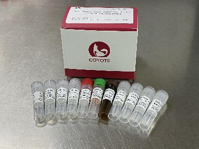 DirectPrep 2019-nCoV Detection Kit (PCR-Fluoresence Probe) Anti Coronavirus